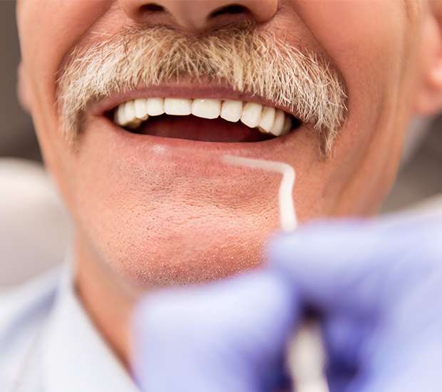 Maywood Adjusting to New Dentures