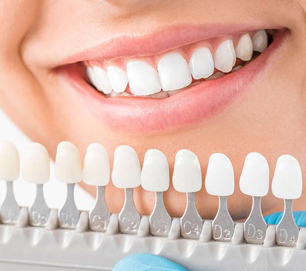 Maywood Cosmetic Dentist