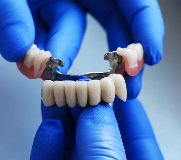 Maywood Dental Bridges