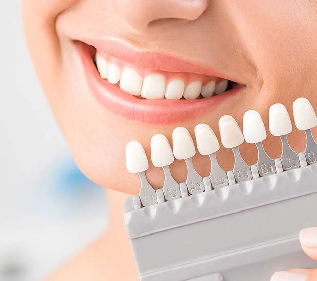 Maywood Dental Veneers and Dental Laminates
