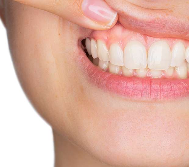 Maywood Gum Disease