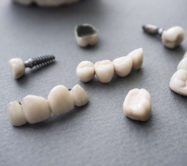 Maywood The Difference Between Dental Implants and Mini Dental Implants